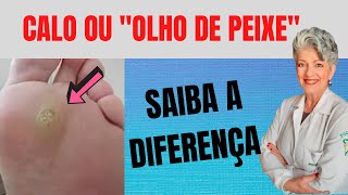 OLHO DE PEIXE NO PÉ O QUE ISSO QUER DIZER [upl. by Hessney]