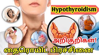 Thyroid symptoms in tamilHypothyroidism symptoms in tamilthyroid problems in women tamilTSH Test [upl. by Clapp]