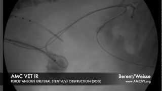 AMC IR perc ureteral stent TCC [upl. by Horan]