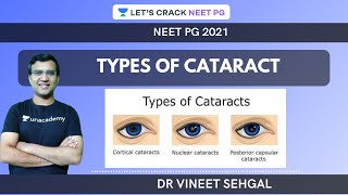 Types of Cataract  NEETPG 2021  Vineet Sehgal [upl. by Naujid]