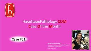 Case 51  HacettepePathology  Case of the Month COM [upl. by Oremodlab]