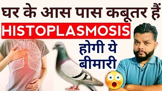 Histoplasmosis Causes Symptoms amp Treatment In Hindi  Histoplasma Capsulatum [upl. by Henarat27]