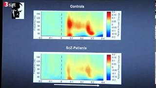 Schizophrenie  Was passiert im Kopf [upl. by Nirac504]