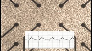 Beating Cardiomyocytes [upl. by Jollanta]