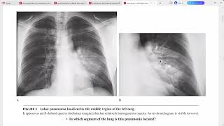 EMERGENCY RADIOLOGY CASE STUDIES [upl. by Amsirahc]