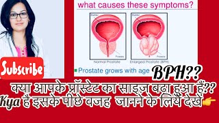 BPH Prostate Enlargement Common Causes गदूद का फूलनाप्रॉस्टेटSymptomsByDr Rukmani Choudhary [upl. by Arni482]