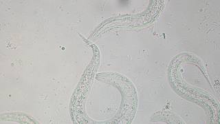 Strongyloides stercoralis larvae x400  Dog [upl. by Helaine]