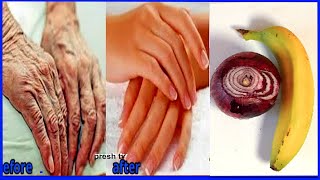 Onion anti wrinkle home remedies to remove wrinkles from hands in 5 days Get rid of wrinkles on hand [upl. by Kolnick553]