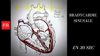 Arythmies Animation cardiaque et ECG  Bradycardie Sinusale Shorts [upl. by Ahsyekat]