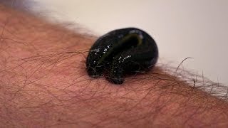 Michael Mosley is bitten by a leech  Infested Living with Parasites  BBC Four [upl. by Ecnedurp]