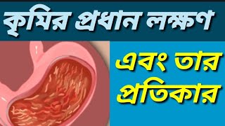 কৃমি হওয়ার লক্ষণ বা উপসর্গ। পেটের কৃমি দূর করার সহজ উপায়।How to identify intestinal worm infection [upl. by Enilrad]