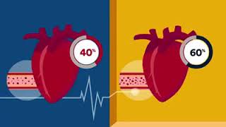 Ejection Fraction  Heart Health  Rose Heart amp Vascular Center [upl. by Dayna214]