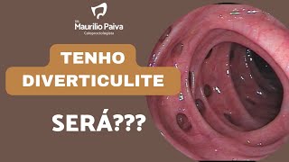 Eu tenho DIVERTICULITE SERÁ diverticulite colonoscopia [upl. by Mot]