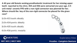 NEET MDS  INICET  Prostho  Fixed Partial Denture  Explanatory Video  MERITERS [upl. by Livy]