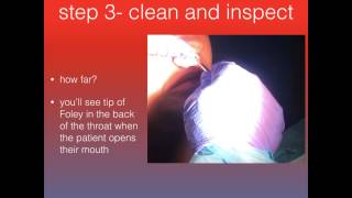 Posterior Epistaxis Packing [upl. by Faus]