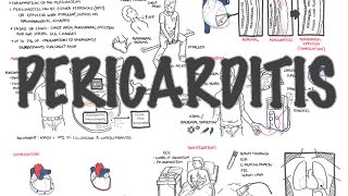 Pericarditis  Overview signs and symptoms pathophysiology diagnosis treatment [upl. by Winou]