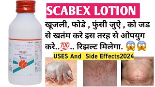 SCABEX LOTION  USE IN HINDI 2024  NEW scabies scabex bacteria infection medicine allergy [upl. by Wolsky668]