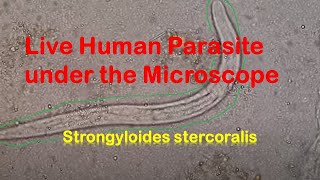 Human Parasites Live under the Microscope  Strongyloides stercoralis [upl. by Yramliw]