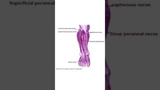 Common peroneal nerve lesion  features [upl. by Shani]