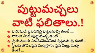 పుట్టుమ‌చ్చ‌లు వాటి ఫ‌లితాలు  dharma sandehalu telugu  puttumachalu  moles [upl. by Messere]