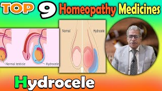 Hydrocele Causes Symptoms and homeopathy Treatment  Dr P S Tiwari [upl. by Eilyah]