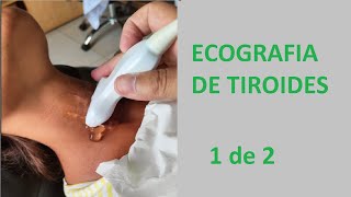 Ecografia de Tiroides 1 de 2 [upl. by Mateusz804]