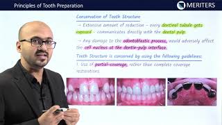 NEET MDS  INICET  Prostho  Fixed Partial Denture  Principles of tooth preparation  MERITERS [upl. by Samuella]