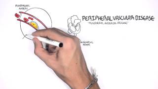 Cardiovascular Disease Overview [upl. by Adyol]