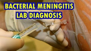 BACTERIAL MENINGITIS LAB DIAGNOSIS [upl. by Proctor]