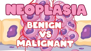 Neoplasia  benign vs malignant tumors  General pathology [upl. by Reivazx]