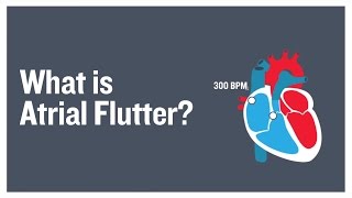 What is atrial flutter [upl. by Octave]