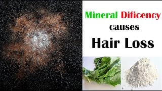 Hair Loss is Caused by Mineral Deficiency  Diatomaceous Earth  Rapini [upl. by Melborn]