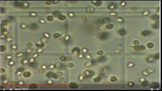 How to count Rbcs amp Wbcs content using Hemocytometer [upl. by Niwdla486]