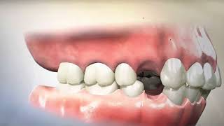 Removing Teeth for Braces  Why Extracting and Retracting Orthodontics is harmful [upl. by Aynat951]