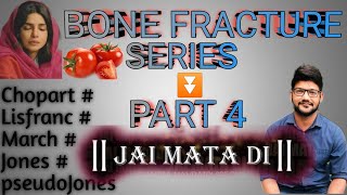 Dr Tricks  Bone Fracture Series  PART 4  Made easy with Tricks and Mnemonics 🔥 [upl. by Nnahoj]