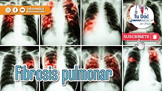 ¿Qué es la fibrosis pulmonar 👨🏻‍⚕ [upl. by Ellerrad719]