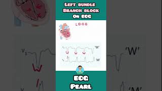 LBBB Left Bundle Branch Block on ECG  quick mnemonic for USMLE NEET PG INICET NCLEX mednotes [upl. by Markus356]