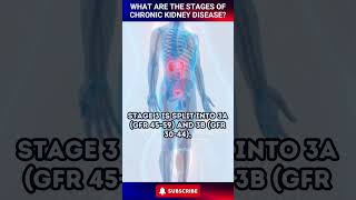 What are the Stages of Chronic Kidney Disease shorts [upl. by Veleda]