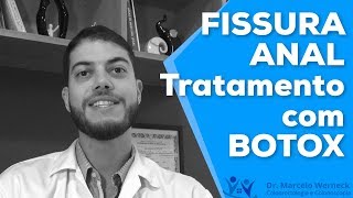 Tratamento de fissura anal com Botox  Dr Marcelo Werneck [upl. by Elletsyrk]