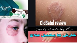 How to use CLOBETOL ointment USP 5gmpriceusesreviewkshaf zhra vlog [upl. by Burnett]