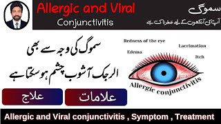 Smog Effect On Eyes  Allergic and Viral Conjunctivitis  Symptom Treatment Nafamine DrAHMandal [upl. by Malek54]