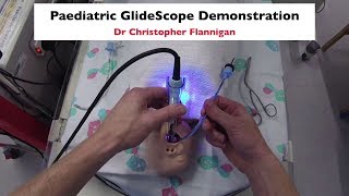 GlideScope Demonstration [upl. by Valentino]