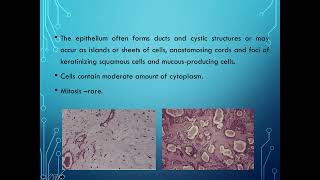 BDS 303 PLEOMORPHIC ADENOMA WARTHINS TUMOR BY DR ANKITA SINGH [upl. by Alyakam]