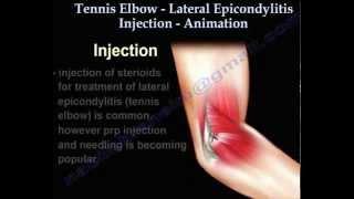 ORTHOMED Elbow US guided Injection [upl. by Card387]