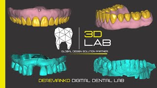 IMMEDIATE FULL DENTURES DESIGN  EXOCAD 2023 [upl. by Anorahs873]