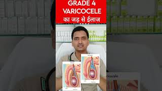 Varicocele homeopathic medicine in hindi  varicocele treatment without surgery grade 4 varicocele [upl. by Diane-Marie]