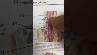 Réponse Quiz sur sténose foraminale  hernie discale [upl. by Alvita]