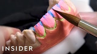 How This Dentist Crafts 80000 Veneers For Celebrities  Beauty Explorers [upl. by Irek]