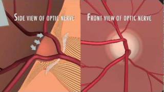 Optic Nerve Fibers [upl. by Buffo]