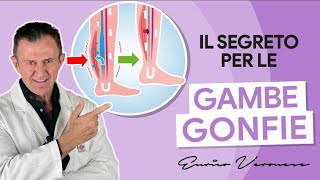 4 Soluzioni Pratiche per la Ritenzione Idrica Gambe e Caviglie [upl. by Niggem]